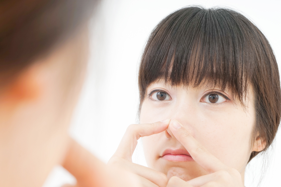 なぜいちご鼻になってしまうの?