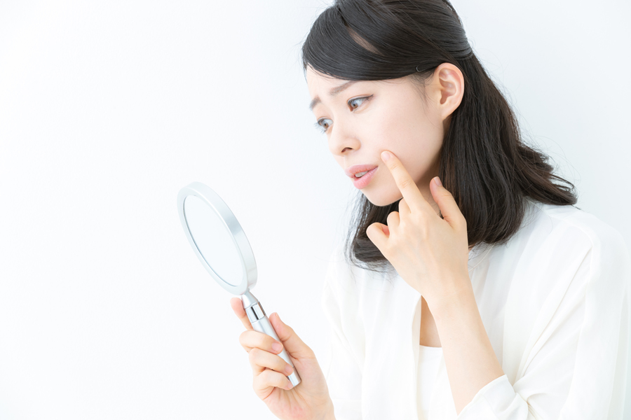 乾燥肌は顔ダニを異常発生させる原因です
