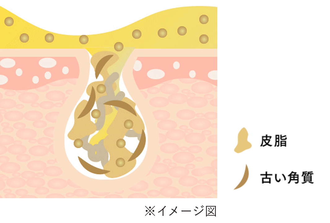 古い角質や汚れをするんと浮かせる